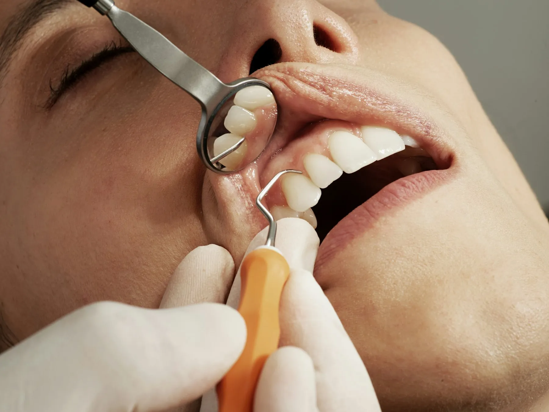 Close-up of a gentle dental cleaning with a mirror and scaler